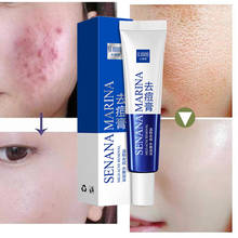 Okeny's Anti Acne Pimple Cream Repair Acne Scars Anti Inflammatory Face Beauty Smooth Skin Care Oil Control Vera Aloe Gel 2024 - buy cheap