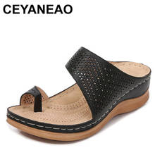 CEYANEAO-Sandalias planas de plataforma cómodas para mujer, zapatos transpirables con huecos, corrector ortopédico bunioneao 2024 - compra barato