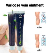 100% Original Medicine PlasterTreatment Spider Veins Varicose Ointment Varicose Veins Vasculitis Health Care Cream 2024 - buy cheap