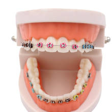 Modelo de dientes de ortodoncia Dental con tubos bucales dentales, modelo de dientes de estudio dental con soportes dentales de metal, modelo de dientes dentales 2024 - compra barato