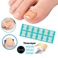 Ingrown Toenail Corrector Sticker Toe Nail Toenail Correction Treatment Pedicure Foot Care Stickers for Damaged Thick Black Nail 2024 - buy cheap