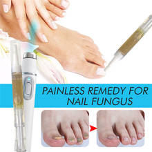Anti-fungal Home Treatment Set Laser Pen Finger Toe Nail Fungus Care Liquid Kit 2024 - buy cheap