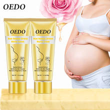 1pcs OEDO Stretch Marks Cream Maternity Repair Treatment Eliminate Pregnancy Scars & Anti Winkle Firm Skin 2024 - buy cheap