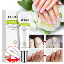 Nail Repair Essence Serum Fungal Nail Treatment Removal Gel Anti Infection Onychomycosis Toe Nail Nourishing for Hand Foot Care 2024 - купить недорого