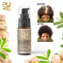 20ml Hair Growth Essence Oil Ginger Extract Prevent Hair Loss Baldness Growth Hair Care Cure Calp Strengthen Hair Treatment Oil 2024 - buy cheap