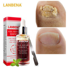 LANBENA Fungal Nail Repair Serum Treatment Care Foot Nail Fungus Removal Gel Anti Infection Paronychia Onychomycosis Nail Care 2024 - buy cheap
