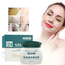 50g Chicken Skin Repair Body Lotion Remove Goose Bumps Cream for Women Moisturizing And Nourishing Skin Care Essence 2024 - buy cheap