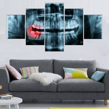 Panoramic Dental X Ray 5 Pieces Modern Canvas Painting Oil Print Poster HD Picture For Living Room Office Home Decoration 2024 - buy cheap