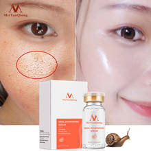 MeiYanQiong Natural Pure Snail Essence Liquid Hyaluronic Acid Whitening Spot Snail Essence Acne Rejuvenation Essence Skin Care 2024 - buy cheap