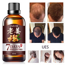 30ML Ginger Hair Growth Oil Hair Care Healthy Nourishing Anti Hair Loss Treatment Fast Dense Regrowth Ginger Serum TSLM1 2024 - buy cheap
