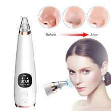 Blackhead Skin Care Dropshipping Discounted Price Face Deep Pore Acne Pimple Removal Vacuum Suction Facial Diamond Beauty Tool 2024 - buy cheap