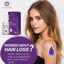 Spray para perda de cabelo, óleo essencial para tratamento de perda de cabelo, ajuda para o crescimento rápido do cabelo 2024 - compre barato