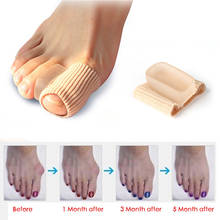 2 pçs hallux valgus corrector para dedos dos pés silicone bandagem correção valgus do polegar grande dedo do pé separador ferramenta de cuidados com os pés 2024 - compre barato