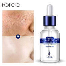 Anti-rugas anti-rugas anti-acne essência líquida hidratante soro para rosto soro hidratante para rosto 2024 - compre barato