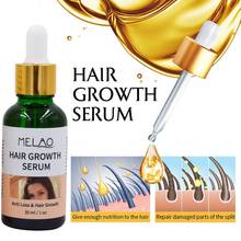 Tratamento de cabelo para seco e manutenção, 30ml, nutrição capilar, óleo essencial para crescimento do cabelo, bom uso, essência natural pura 2024 - compre barato