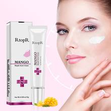 Crema facial reparadora para el acné, crema blanqueadora de larga duración, hidratante, para el cuidado de la piel 2024 - compra barato