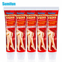 Sumifun-Crema para venas varicosas, pomada para aliviar el dolor de venas, flebitis, piernas, venas varicosas, 5 uds. 2024 - compra barato