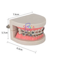 Modelo Dental de enseñanza, tratamiento Dental con soporte de cerámica y Metal Ortho, alambre de arco, ligaduras de tubo bucal 2024 - compra barato