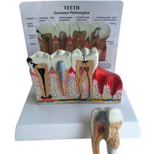 Modelo anatômico dos dentes dentais, modelo anatômico dos dentes, modelo de dentes de anatomia grande 2024 - compre barato
