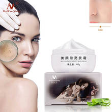 Strong Effects Powerful Whitening Freckle Cream Remove Melasma Acne Spots Pigment Melanin Moisturizing Face Skin Care 40g 01 2024 - buy cheap