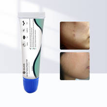 Creme removedor de cicatriz 8g, creme facial para remoção de estrias de cicatriz acne e manchas 8g 2024 - compre barato