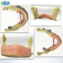 1 Piece Dental Implant Practice Teeth Model with Imitation Bone (Drilling) Silicone Soft Gum (Cutting/Stitching) Lower Jaw 2024 - buy cheap