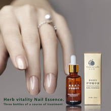 30ml Chinese Toe Nail Fungus Treatment Anti Fungal Nail Removal Nail Care Lotion TSLM2 2024 - buy cheap