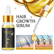 MO TULIP Ginger Fast Hair Growth Serum Essential Oil Anti Preventing Hair Lose Liquid Damaged Hair Repair Growing Women Men 2024 - buy cheap
