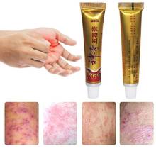 10 peça yiganerjing psoríase pomada dermatite eczematoid eczema pomada tratamento da pele creme 2024 - compre barato