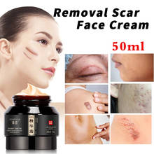 50ml Removal Scar Face Cream Serum Pimples Scar Stretch Marks Removal Acne Treatment Deep Moisturizing Cream Smooth Skin Care 2024 - buy cheap