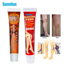 Sumifun creme médico de fleblita, 2 tipos, aranha, creme de angite para perna, varanda, tratamento, pomada, gesso médico 2024 - compre barato