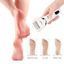 CkeyiN Electric PedicureTools Callus Remover 3 Replaceable Rollers Foot File Pedicure Tools Hard Skin Remover Pedicure Machine45 2024 - buy cheap
