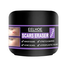 Scar Removal Cream Effective Scar Remover Gel For Acne Spots Pimples Stretch Marks Gel Whitening Moisturizing Body Skin Care 2024 - buy cheap