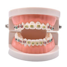 Modelo de tratamiento de ortodoncia Dental con soporte de cerámica de Metal Ortho, lazos de ligadura de tubo bucal, herramientas dentales, modelo de dientes 2024 - compra barato