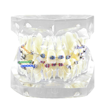 Dentais typodon dentes modelo demonstrar tratamento/dental estudo modelo com suporte e fio de ligadura/ortodôntico modelo M3005-3 2024 - compre barato