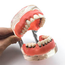 Modelo de dientes para adultos, modelo Dental tipodno, simulación de enfermedades patológicas y peridontales 2024 - compra barato