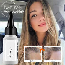 20 Ml Hair Growth Essential Oil Effective To Prevent Hair Loss Natural Healthy Hair Growth Hair Care Plant Nutrient Solution 2024 - buy cheap