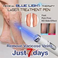 Blue Light Therapy Laser Pen Face Massager Acne Scar Wrinkle Removal Treatment Skin Care Tools 2024 - buy cheap