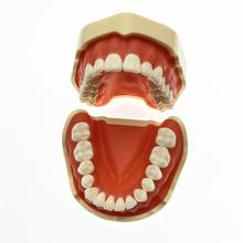 Modelo de dentes com ímã gingiva dental macia, modelo de simulação de ensino de dentes removível 2024 - compre barato