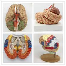 detachable Human brain anatomy model cerebrovascular brain model medical teaching equipment 2024 - buy cheap