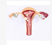 big sale! 1 set Uterus Ovary Anatomical Model Anatomy Cross-Section H# 2024 - buy cheap