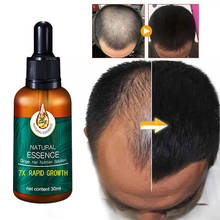 Уход За Волосами Эфирные масла для роста волос эссенция оригинальная Подлинная жидкость для выпадения волос Лечение красоты Сыворотка для роста густых волос # E 2024 - купить недорого