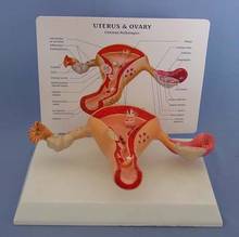 Cervical e ovário, modelo feminino de cervical, modelo vaginal, mudanças patológicas, estrutura obstétrica, auxiliares de ensino 2024 - compre barato