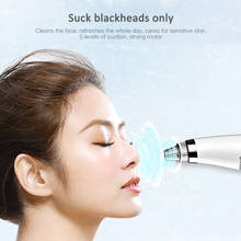 Electric Blackhead Remover Face Deep Nose Cleaner T Zone Acne Pimple Removal Skin Care Pore Cleaner Vacuum Acne Cleanser TSLM1 2024 - buy cheap