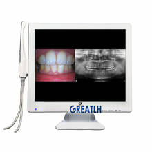 Monitor odontológico, câmera intraoral de led, hd, lente macro, 17 polegadas, monitor dentário com suporte, adequado para cadeiras dentárias, laboratório dental/mecânico aequipamento 2024 - compre barato