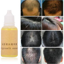 Натуральный чистый 20 мл эссенция для роста волос, жидкость для выпадения волос, оригинальные эфирные масла, сыворотка для роста густых волос, масла для ухода 2024 - купить недорого