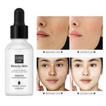 Niacinamida clareamento essência facial hidratação profunda anti-acne soro reparos pele impede melanina iluminar o líquido de cuidados com a pele 2024 - compre barato