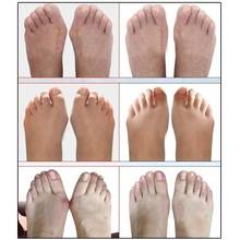 1Pair Hallux Valgus Braces Big Toe Orthopedic Bunion Separator Sleeve Correction Relieve Care Toes Feet Bone Pain Socks Thu S3V8 2024 - buy cheap
