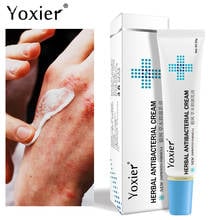 Yoxier Herbal Antibacterial Cream Psoriasis Cream Anti-itch Relief Eczema Skin Rash Urticaria Desquamation Treatment 20G 2024 - buy cheap