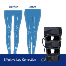 XO-Type Leg Correction Belt Inflatable Charming Long Leg Belt Enhanced Type Double Fixation Foot Care Tool for Adult Children 2024 - buy cheap